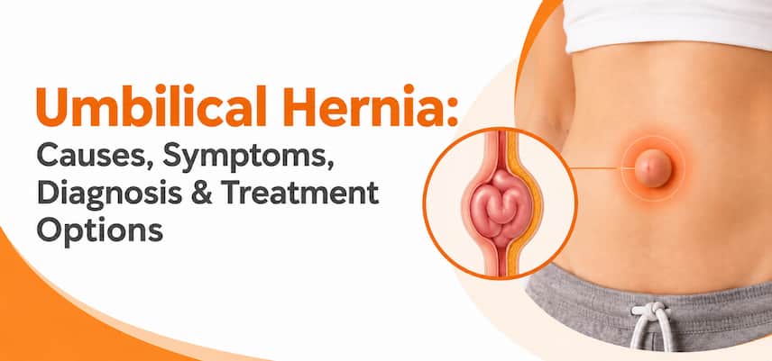 Umbilical Hernia: Causes, Symptoms, & Treatment Options